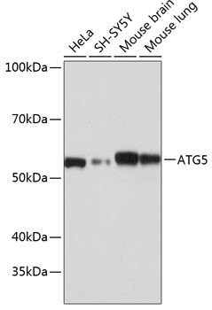 ATG5 Antibody in Western Blot (WB)