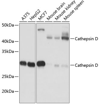 Cathepsin D Antibody in Western Blot (WB)