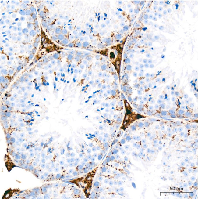 Cathepsin D Antibody in Immunohistochemistry (Paraffin) (IHC (P))