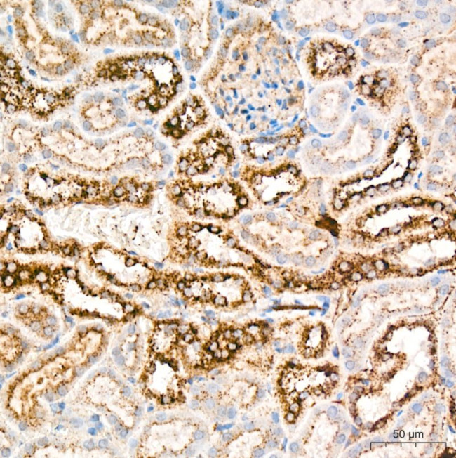 Cathepsin D Antibody in Immunohistochemistry (Paraffin) (IHC (P))