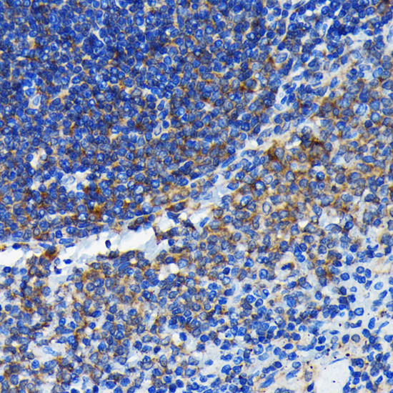 BAX Antibody in Immunohistochemistry (Paraffin) (IHC (P))