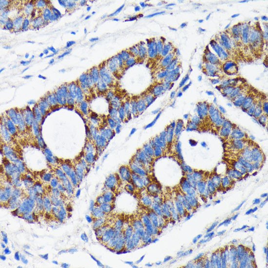 BAX Antibody in Immunohistochemistry (Paraffin) (IHC (P))