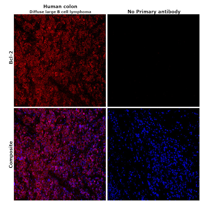 BCL-2 Antibody in Immunohistochemistry (Paraffin) (IHC (P))