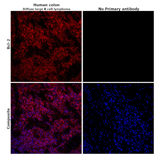 BCL-2 Antibody in Immunohistochemistry (Paraffin) (IHC (P))