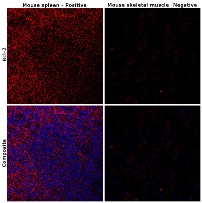 BCL-2 Antibody in Immunohistochemistry (Paraffin) (IHC (P))