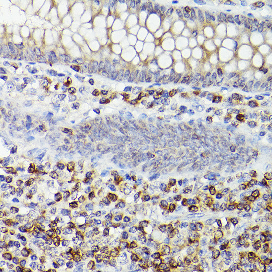 BCL-2 Antibody in Immunohistochemistry (Paraffin) (IHC (P))