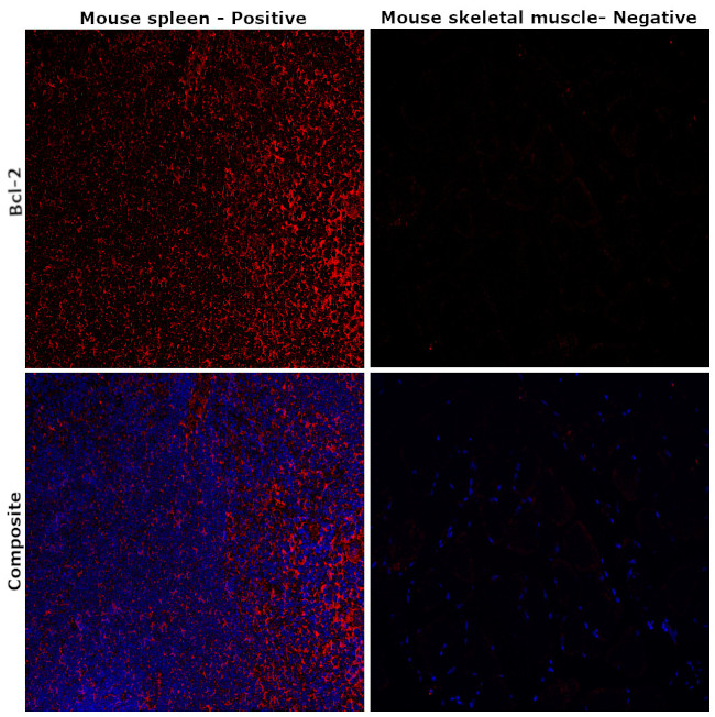 BCL-2 Antibody in Immunohistochemistry (Paraffin) (IHC (P))