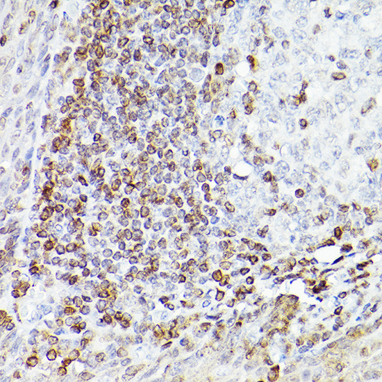 BCL-2 Antibody in Immunohistochemistry (Paraffin) (IHC (P))