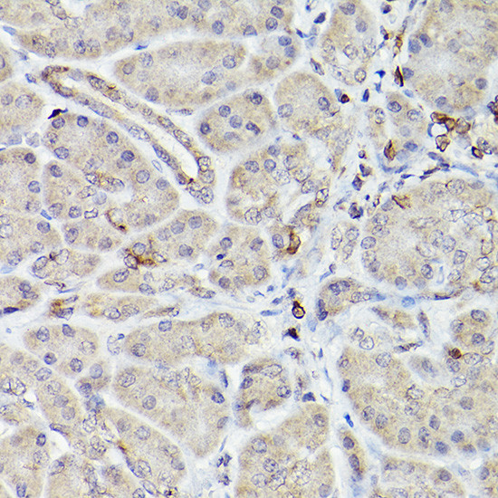 BCL-2 Antibody in Immunohistochemistry (Paraffin) (IHC (P))