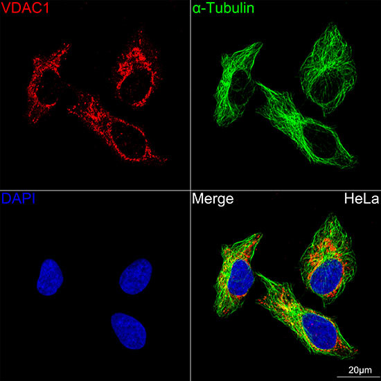 VDAC Antibody in Immunocytochemistry (ICC/IF)