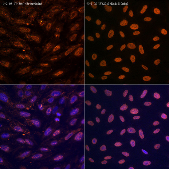 N6-Methyladenosine (m6A) Antibody in Immunocytochemistry (ICC/IF)