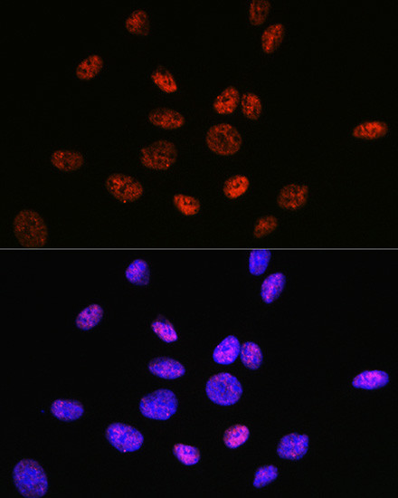 HDAC9 Antibody in Immunocytochemistry (ICC/IF)