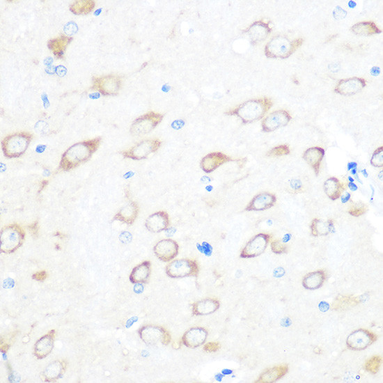 TPT1 Antibody in Immunohistochemistry (Paraffin) (IHC (P))