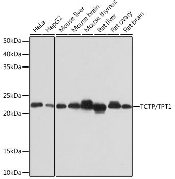 TPT1 Antibody in Western Blot (WB)