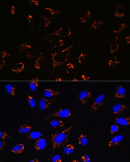 PRDX3 Antibody in Immunocytochemistry (ICC/IF)