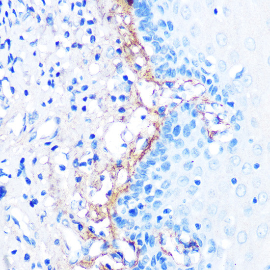 TGFBI Antibody in Immunohistochemistry (Paraffin) (IHC (P))