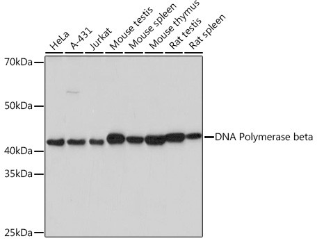 POLB Antibody in Western Blot (WB)