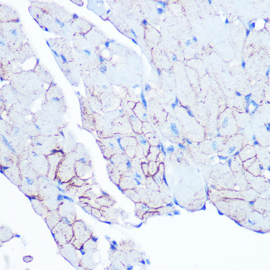 Flotillin 1 Antibody in Immunohistochemistry (Paraffin) (IHC (P))