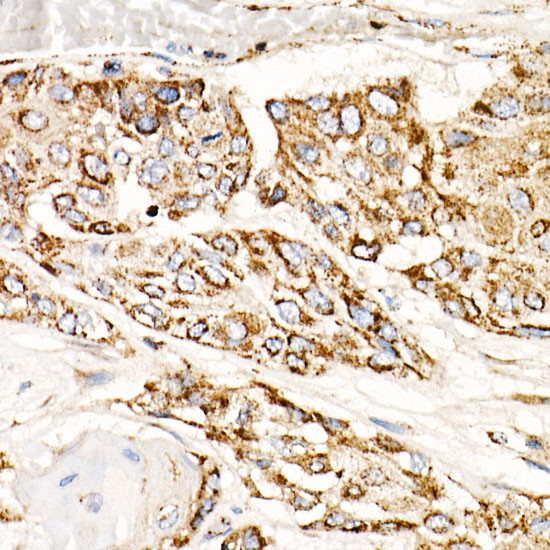 TFAM Antibody in Immunohistochemistry (Paraffin) (IHC (P))