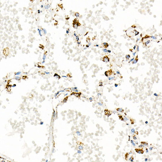 TFAM Antibody in Immunohistochemistry (Paraffin) (IHC (P))