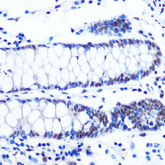 NRF1 Antibody in Immunohistochemistry (Paraffin) (IHC (P))