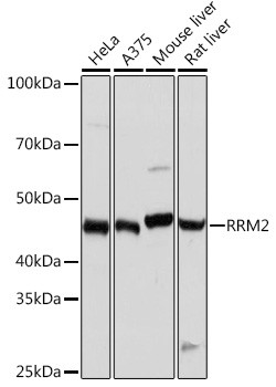 RRM2 Antibody in Western Blot (WB)