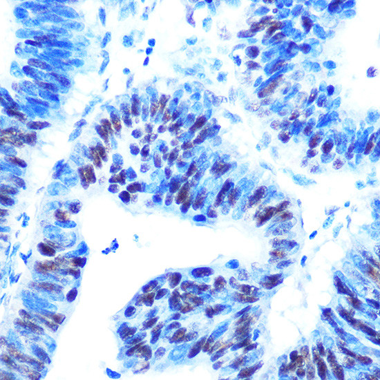 USP7 Antibody in Immunohistochemistry (Paraffin) (IHC (P))