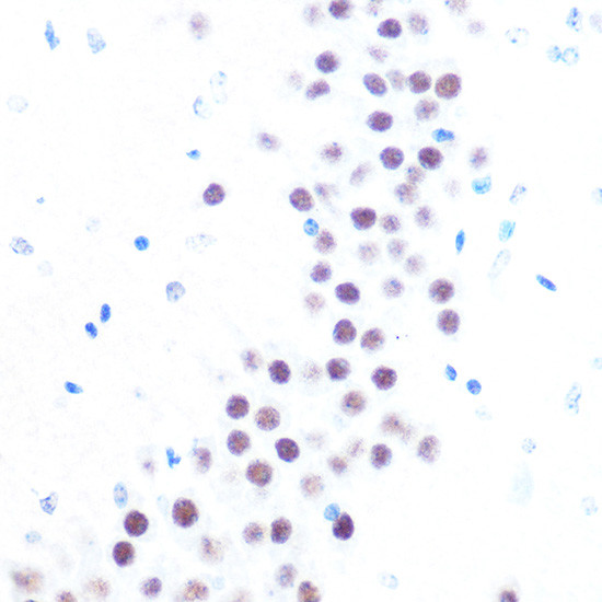 USP7 Antibody in Immunohistochemistry (Paraffin) (IHC (P))