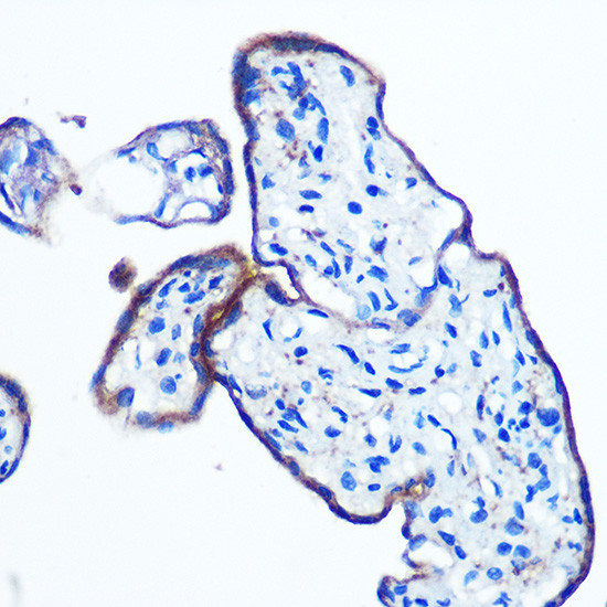 IKK epsilon Antibody in Immunohistochemistry (Paraffin) (IHC (P))