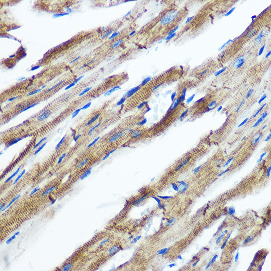 IKK epsilon Antibody in Immunohistochemistry (Paraffin) (IHC (P))