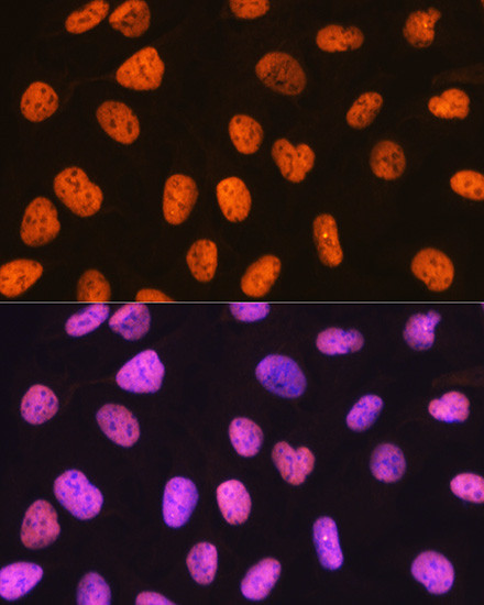 PTBP1 Antibody in Immunocytochemistry (ICC/IF)