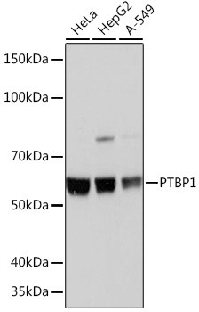 PTBP1 Antibody in Western Blot (WB)