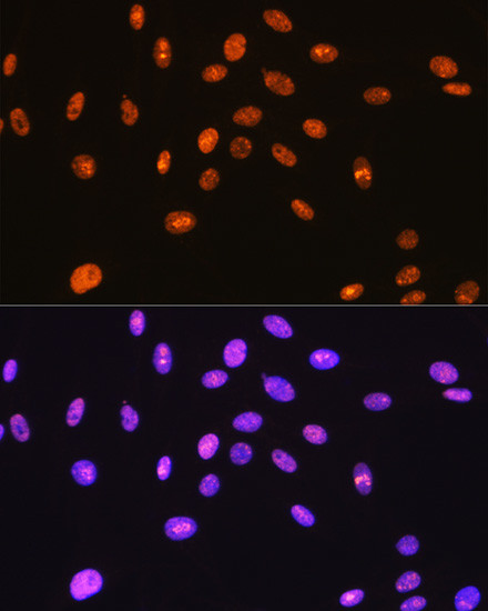 SFPQ Antibody in Immunocytochemistry (ICC/IF)