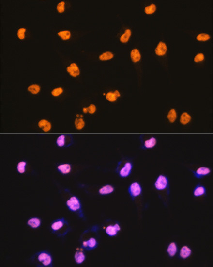 SFPQ Antibody in Immunocytochemistry (ICC/IF)