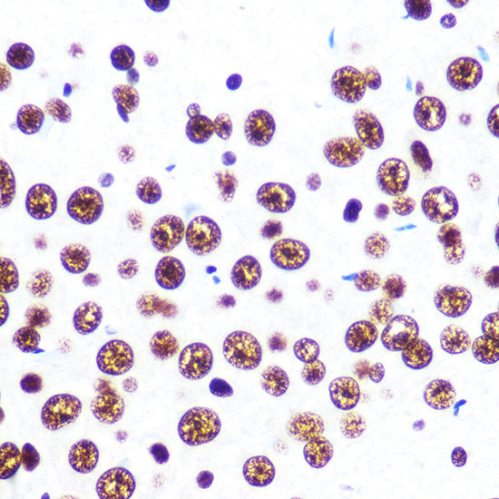 SFPQ Antibody in Immunohistochemistry (Paraffin) (IHC (P))