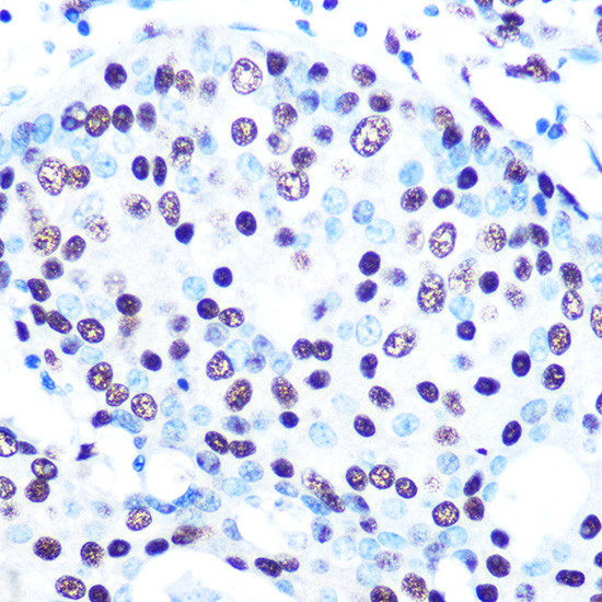 SFPQ Antibody in Immunohistochemistry (Paraffin) (IHC (P))