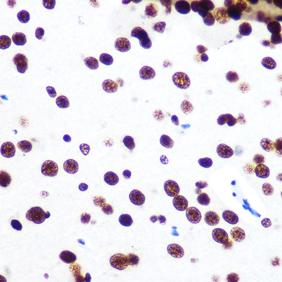 SFPQ Antibody in Immunohistochemistry (Paraffin) (IHC (P))