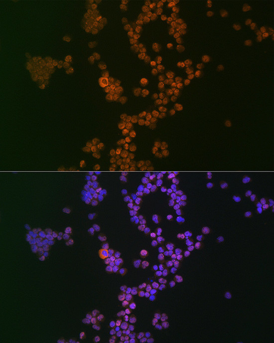 IKAROS Antibody in Immunocytochemistry (ICC/IF)