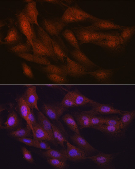 Ub-K48 Antibody in Immunocytochemistry (ICC/IF)