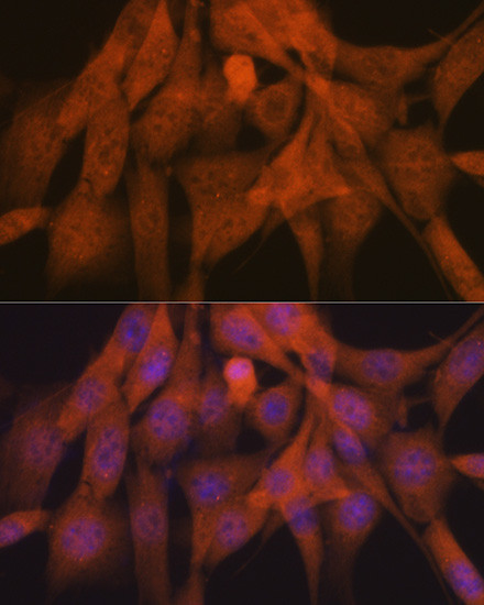 Ub-K48 Antibody in Immunocytochemistry (ICC/IF)