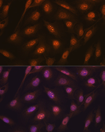 Ub-K48 Antibody in Immunocytochemistry (ICC/IF)