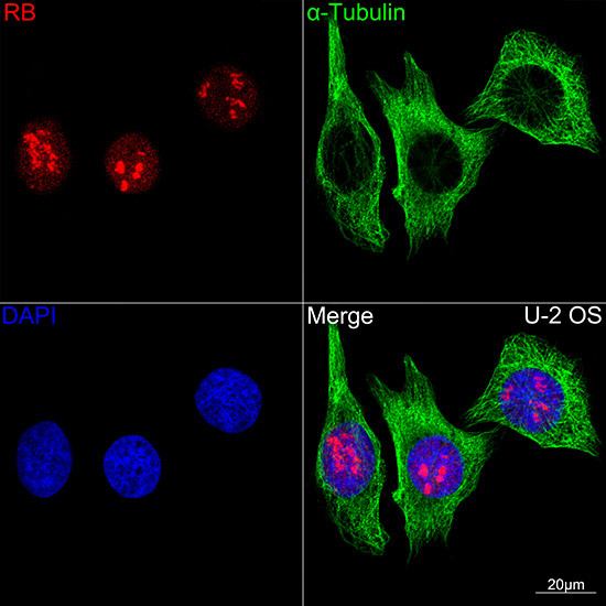 Rb Antibody in Immunocytochemistry (ICC/IF)