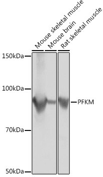 PFKM Antibody in Western Blot (WB)