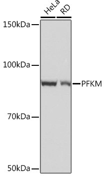 PFKM Antibody in Western Blot (WB)