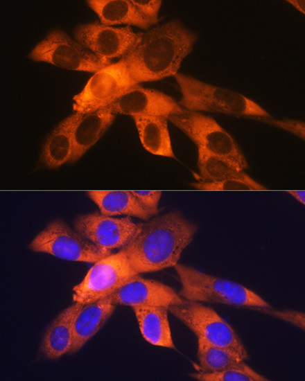 RPS19 Antibody in Immunocytochemistry (ICC/IF)