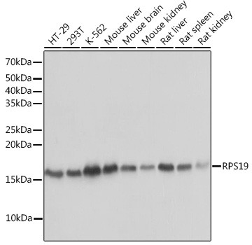 RPS19 Antibody in Western Blot (WB)