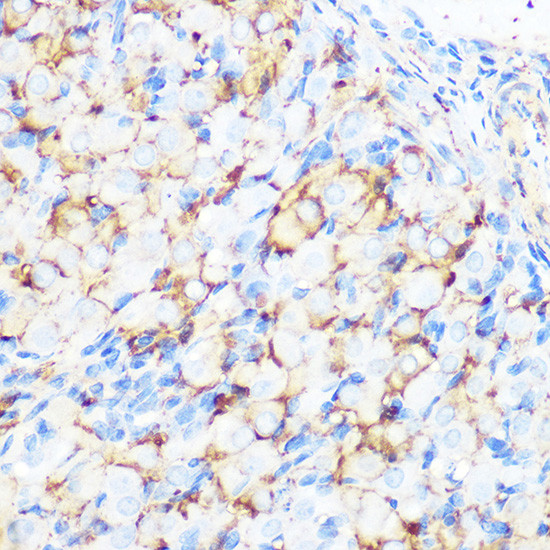 Filamin A Antibody in Immunohistochemistry (Paraffin) (IHC (P))