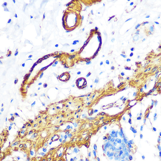 Filamin A Antibody in Immunohistochemistry (Paraffin) (IHC (P))