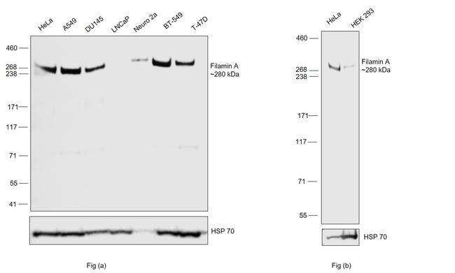 Filamin A Antibody in Western Blot (WB)