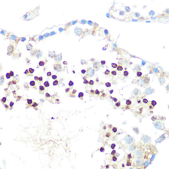 HP1 alpha Antibody in Immunohistochemistry (Paraffin) (IHC (P))